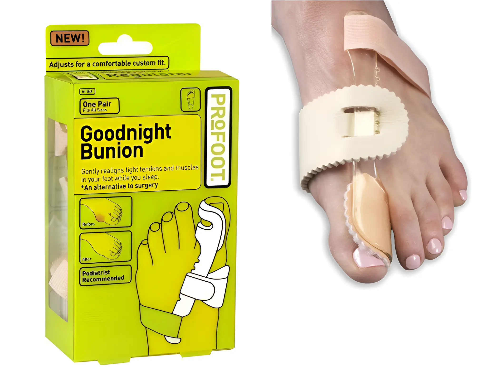 Orthopedic Bunion Corrector Portable Foot Alignment Regulator Pair